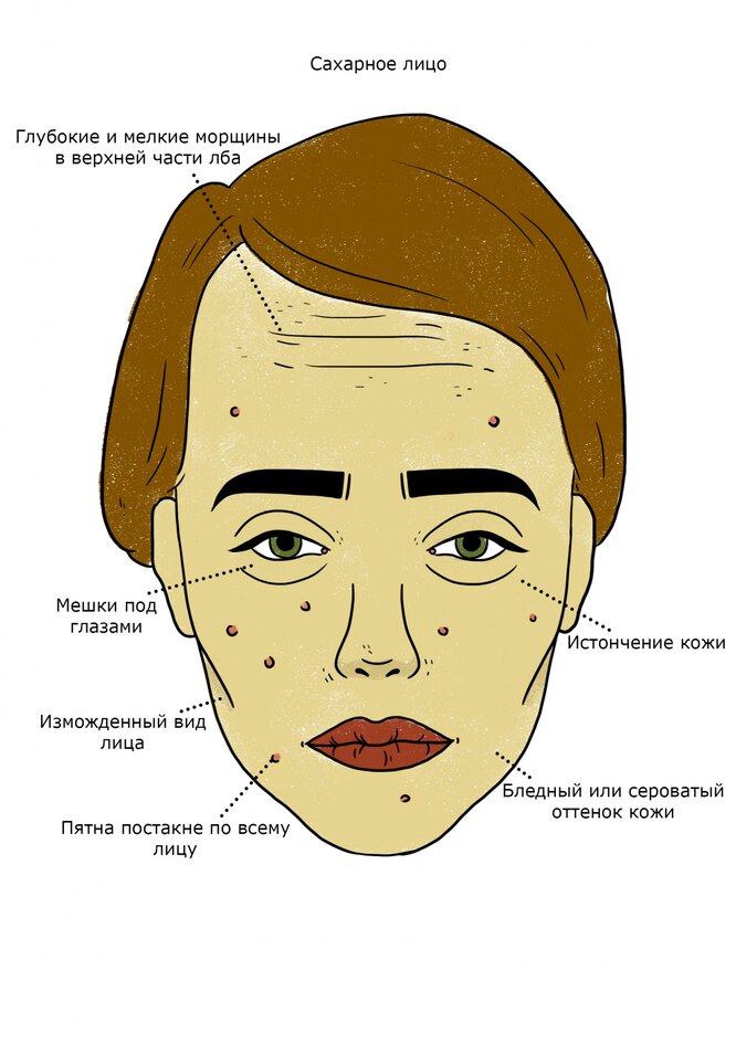 Как сахар, алкоголь и глютен влияют на кожу: как меняется лицо
