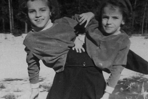 Страшная судьба: история первых сиамских близнецов в СССР
