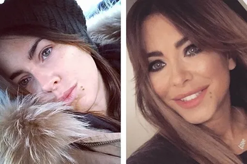 Поклонники раскритиковали 38-летнюю Ани Лорак за фото без макияжа