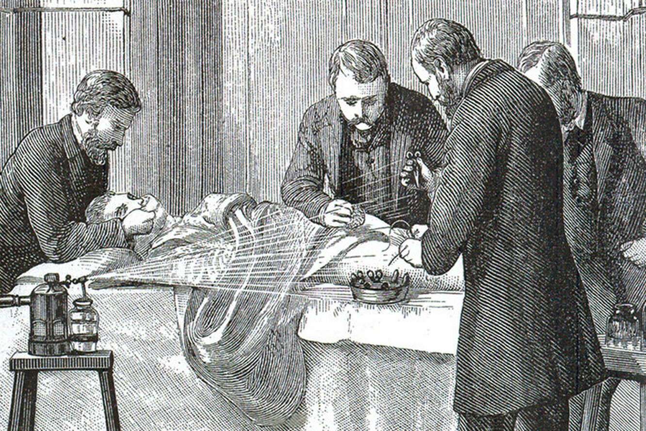 Женское обрезание: почему эта операция была популярна в Викторианской Англи...