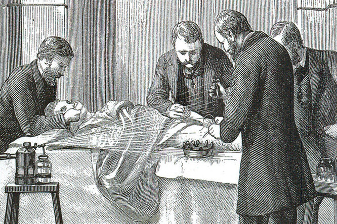 Женское обрезание: почему эта операция была популярна в Викторианской Англии