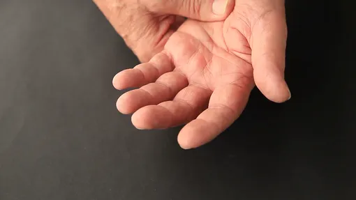Как определить болезни по рукам: симптомы