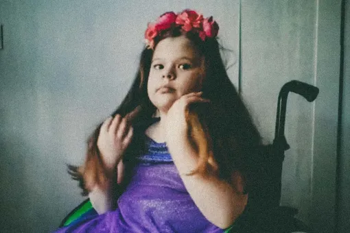«Девочка-русалка»: как живет девочка со spina bifida