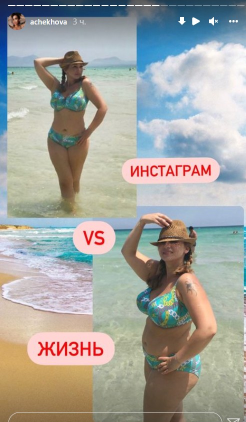 Анфиса чехова до похудения без фотошопа в купальнике