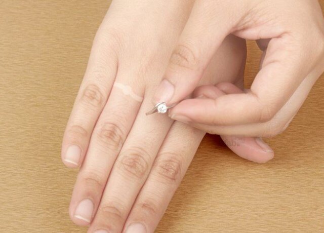 Что делать, кольцо не снимается с пальца: 4 способа снять кольцо с пальца, фото
