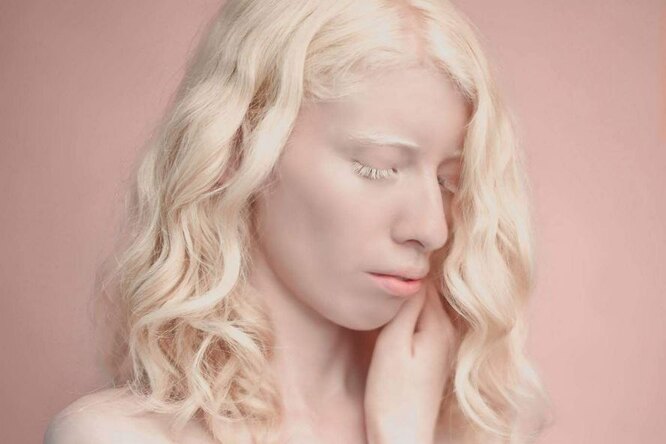 «Я горжусь собой». Мексиканская модель с альбинизмом раздвигает границы красоты