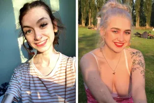 «Анорексия хочет, чтобы вы становились хуже»: студентка из Англии победила недуг и изменилась до неузнаваемости