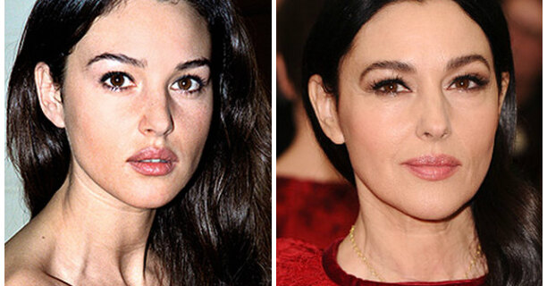 Monica Bellucci Plastic Surgery: Lips, Boobs, Before & After - CelebritySurgeryI