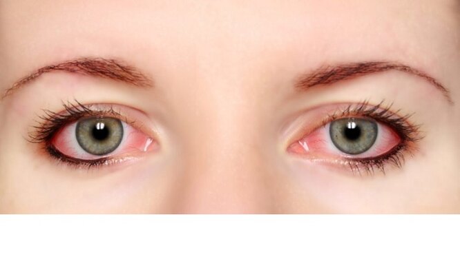 Можно ли определить здоровье по цвету глаз: исследования учёных