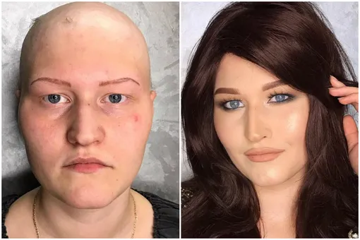 Стилист из Москвы помогает вернуть красоту женщинам, пережившим рак