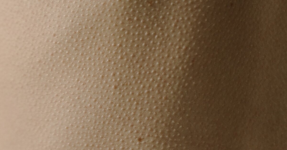 Кожа макросъемка. Почему бегут мурашки. Сильные мурашки. Мурашки на коже. Мурашки по коже.