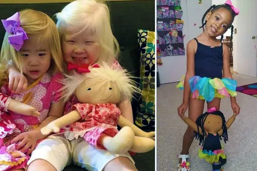 «Кукла как я»: игрушки для детей, которые не похожи на остальных