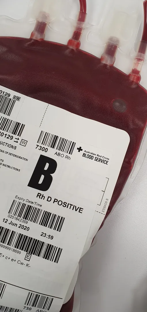 Пациентке потребовалось переливание крови