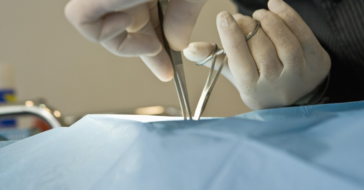 блефаропластика (пластика нижних век). риск послеоперационных тромбоэмболических осложнений таблица. 5. моноциты в анализе крови норма. норма моноцитов 0,25.