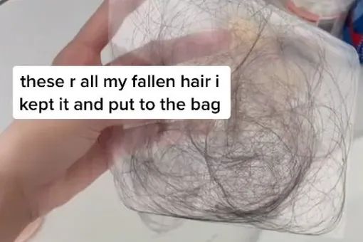 Женщина 8 месяцев собирала свои выпавшие волосы — и вот зачем